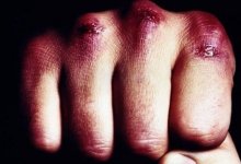 Сотрудники ДЧС подрались в Кокшетау