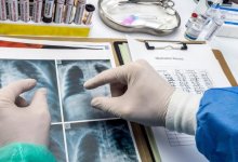 Казахстанские медики: Заболевание Кавасаки может быть очень опасным для детей