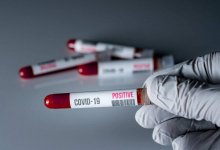 За сутки в Казахстане выявлены 65 заболевших коронавирусом