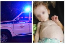 Прожившего полгода в шкафу младенца привезли в больницу на вертолете