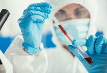 Как коронавирус меняет организм человека: ученые раскрыли механизмы