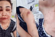 Похитил из скорой, избил и изнасиловал: «НеМолчи.KZ» заявили о преступлении в Павлодаре