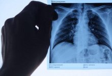 В Казахстане за сутки 10 человек заболели коронавирусной пневмонией