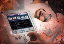 В Казахстан поставляют неработающие аппараты ИВЛ? Ответ Минздрава