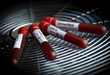 За сутки в Казахстане выявлены 720 заболевших коронавирусом