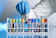 Сто случаев заболевания коронавирусом скрыли в Акмолинской области