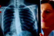 Рак можно распознать по смеху – врачи