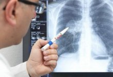 В Казахстане за сутки коронавирусная пневмония выявлена у 215 человек