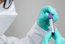 За сутки в Казахстане выявлены 794 заболевших коронавирусом