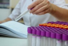 Число заболевших коронавирусом снизилось в Казахстане за сутки