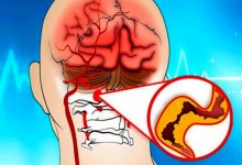 Что делать при болях в голове и шуме в ушах – советы врача