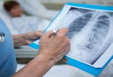 За день от коронавирусной пневмонии в Казахстане скончались четыре человека