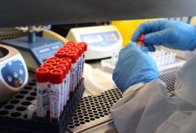 834 заболевших коронавирусом выявили в Казахстане за сутки