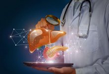 Красные руки предупреждают о смертельно опасной болезни – ученые