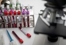 1 141 случай коронавируса выявили в Казахстане за сутки