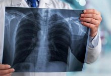 В Казахстане за сутки коронавирусной пневмонией заболели 69 человек