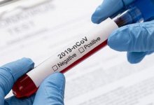 За сутки в Казахстане выявлено 920 заболевших коронавирусом