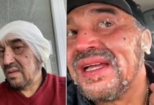 В Карагандинской области мужчина замерз на трассе и отморозил себе уши