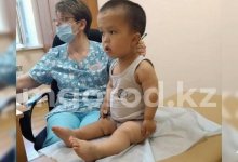 Мальчику из ЗКО с редким заболеванием требуется удлинение рук и ног