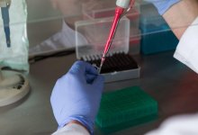 Группа крови влияет на риск развития сердечного приступа – ученые