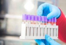 За сутки в Казахстане выявлены 2 054 заболевших коронавирусом