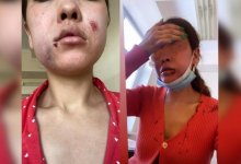 В Туркестанской области мужчина избил бывшую жену на глазах у годовалого ребенка