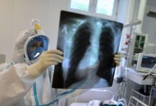 Ни один пациент с пневмонией не скончался за сутки в Казахстане