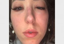 Блогер чуть не уничтожила себе глаза клеем для ресниц. Что было дальше