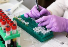Как продлить молодость: ученые из Израиля и США нашли новый способ