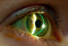 В НИШ начали расследование из-за получивших ожоги глаз школьников Нур-Султана