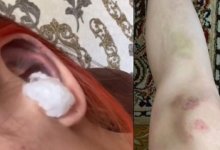 Избили сестру из-за видео в TikTok: делом занялась полиция Караганды