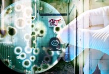 Какие болезни можно подхватить в общественных туалетах Казахстана