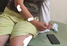 Резал уши и наносил ожоги утюгом: издевательства талдыкорганца над женой шокировали Казнет