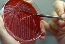 В селе Костанайской области ввели карантин из-за сибирской язвы