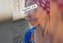 Плохо убралась: невестке выжгли лицо раскаленной вилкой в Туркестанской области