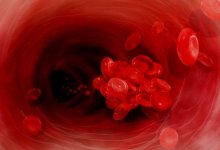 Как переболевшим коронавирусом не умереть из-за тромба – рекомендации врача