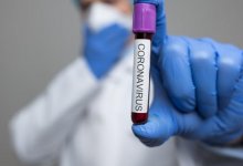 134 казахстанца скончались от коронавируса и пневмонии