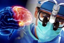 Может привести к смерти: доктор рассказал, чего нельзя делать при инсульте