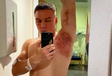 Казахстанского боксера облили кислотой в Англии