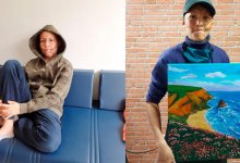 Лицо без шрамов. Как живет мальчик, рисовавший, чтобы оплатить операцию зарубежом