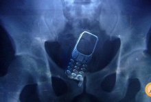 Мужчина пытался пронести телефон в прямой кишке в карагандинскую тюрьму