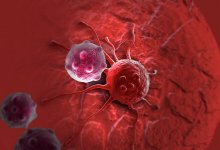 Самый яркий признак рака назвал онколог