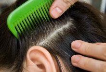 Казахстанец подал в суд на школу. Его дочь заразилась педикулезом