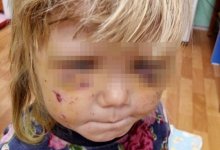 Девочек 3 и 7 лет избил старший брат в Усть-Каменогорске