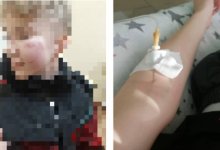В Экибастузе подросток попал в больницу после избиения в школе
