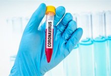 36 казахстанцев заболели коронавирусом за сутки