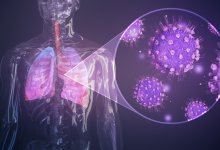 От пневмонии погиб один человек в Казахстане