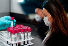 20 новых случаев заболевания коронавирусом зарегистрировано за сутки в Казахстане