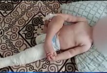 Из детсада на операционный стол попал малыш с травмами в Туркестанской области