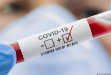 20 казахстанцев заболели коронавирусом за сутки